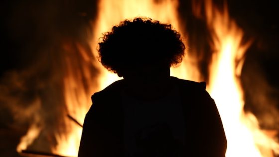 تفسير حلم احتراق الشعر في المنام لابن سيرين
