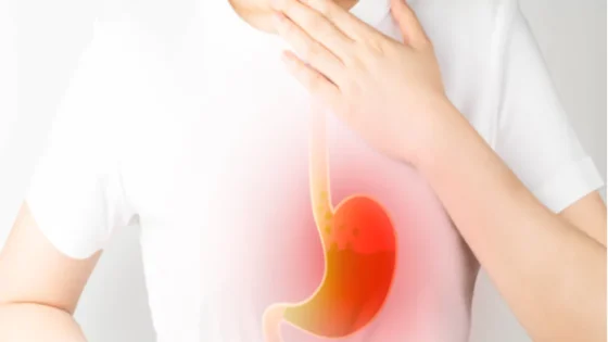هل ارتجاع المريء يسبب دوخة