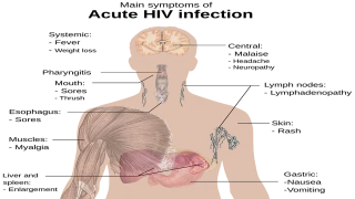 مضاد حيوي لعلاج الغدة النكافية